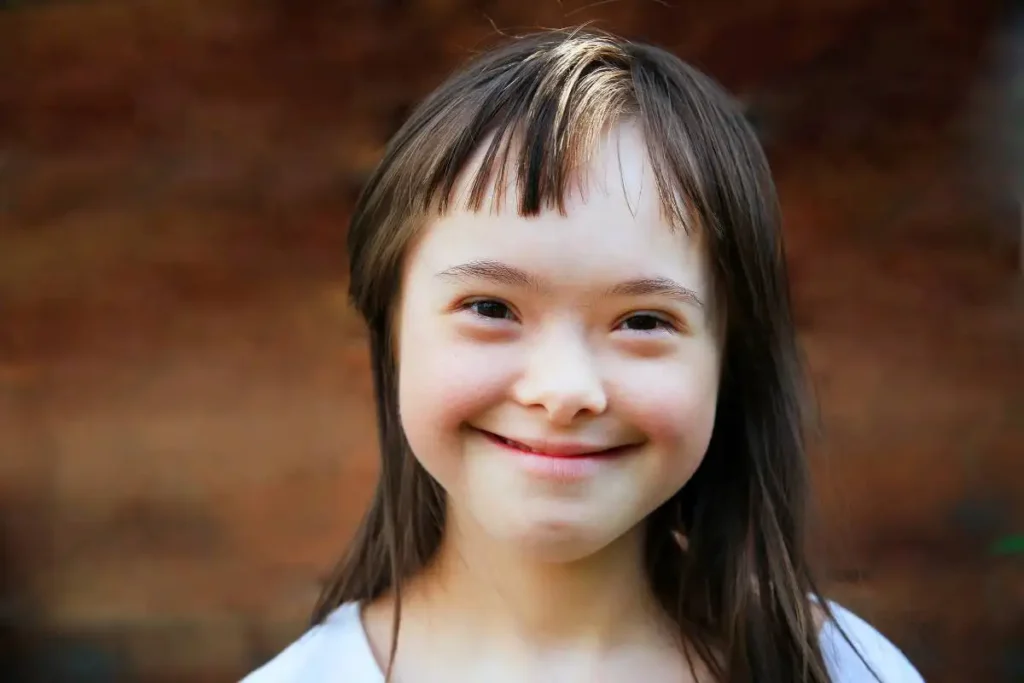 Speech Therapy Techniques for Children with Down Syndrome